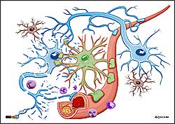 ilustracja medyczna, naukowa, anatomiczna - wizualizacja  komórek nerwowych, glejowcych i naczyń krwionośnych w stanie patologicznym - miażdżycowym